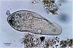 Typical micro-organisms from secondary sludge.